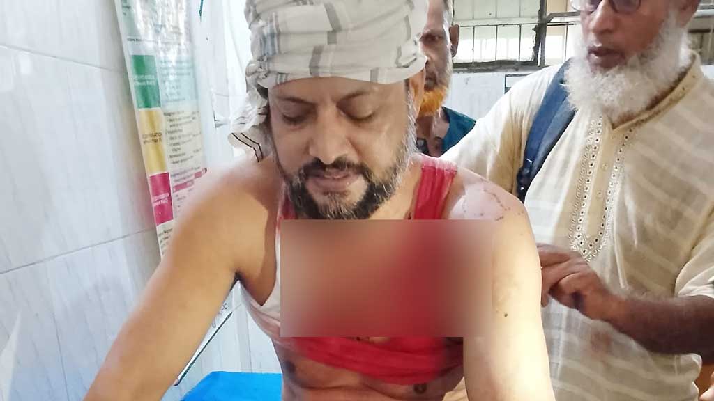 ইন্দুরকানীতে মাদক সেবনে নিষেধ করায় ব্যবসায়ীকে বেধড়ক পিটুনি