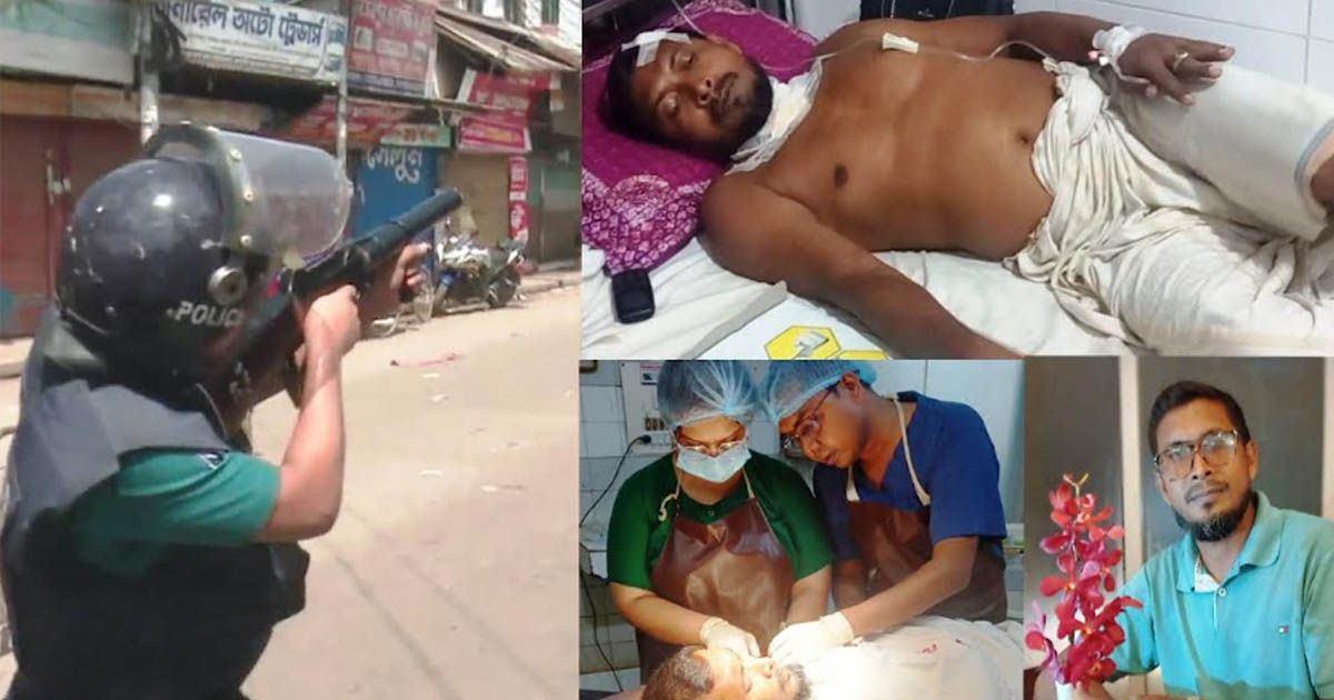 গুলিবিদ্ধ হলেও ‘জুলাই যোদ্ধা’ তালিকায় নেই বরিশালের কালু