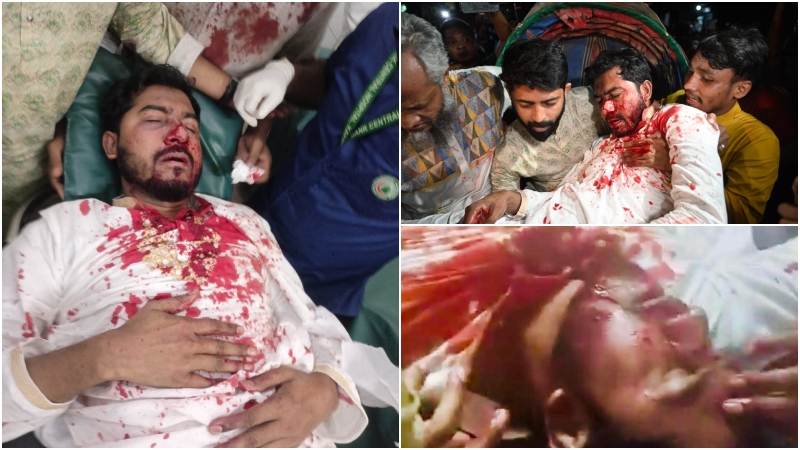 আইনশৃঙ্খলাবাহিনীর সাথে সংঘর্ষে গুরুতর আহত নুরুল হক নুর