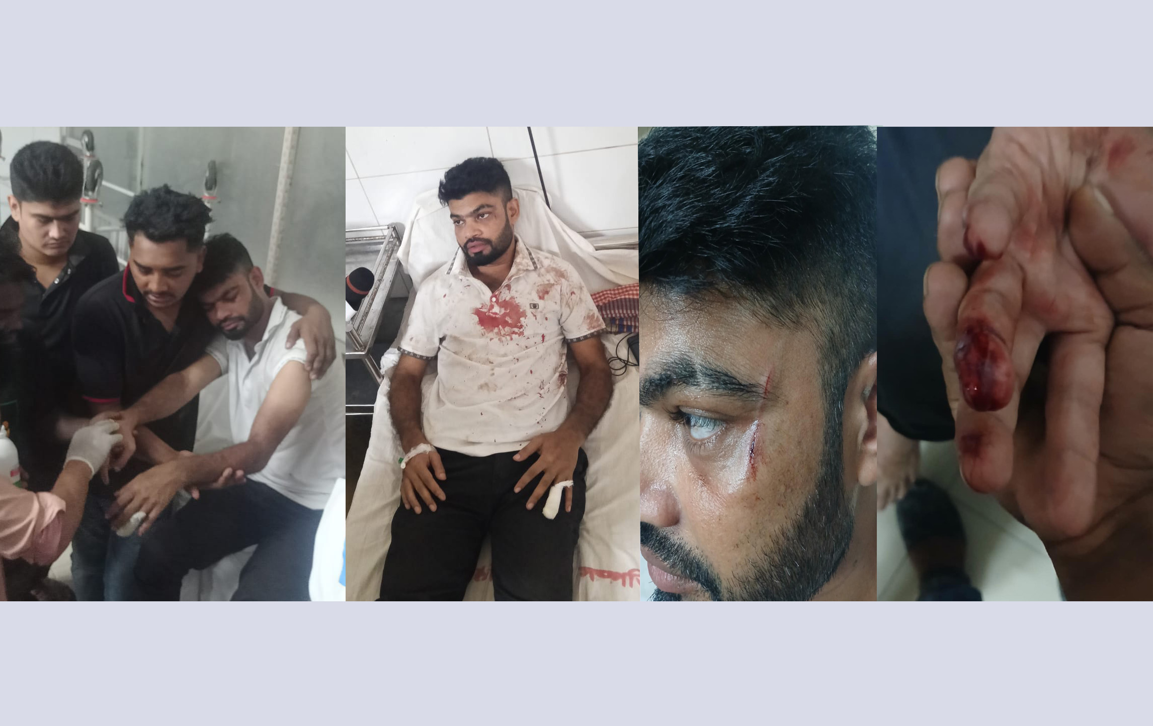 ছাত্রদল নেতা সবুজ আকনের ওপর সন্ত্রাসী হামলা, হাসপাতালে ভর্তি